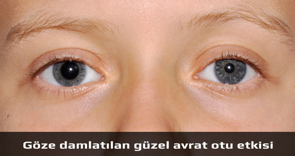 Güzel Avrat Otu Etkisi