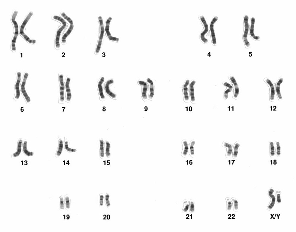 DNA