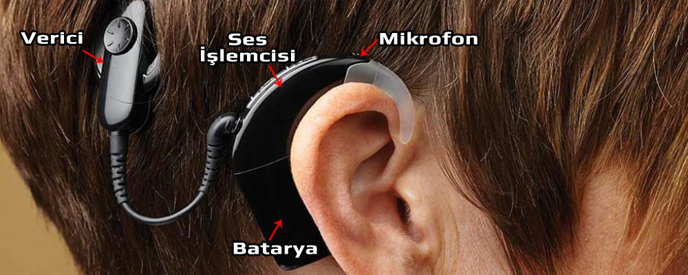 Koklear Dış Kısım