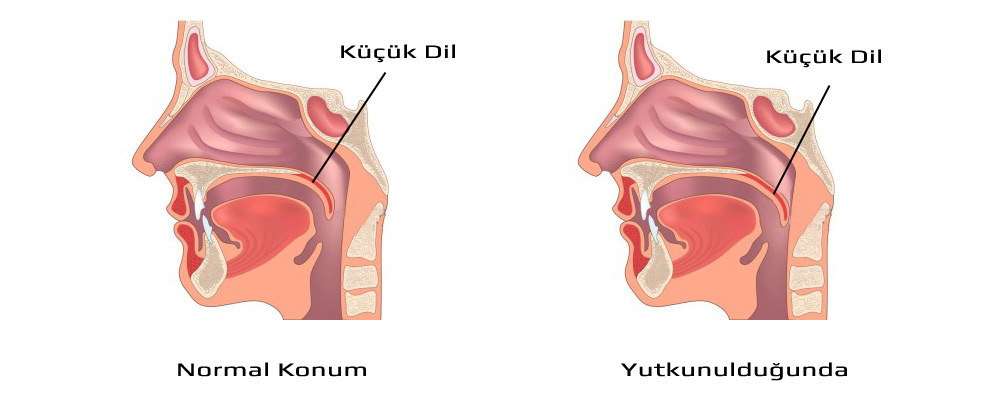 Küçük Dil