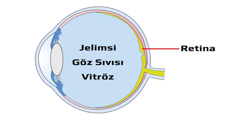 Göz Sıvısı - Virtöz